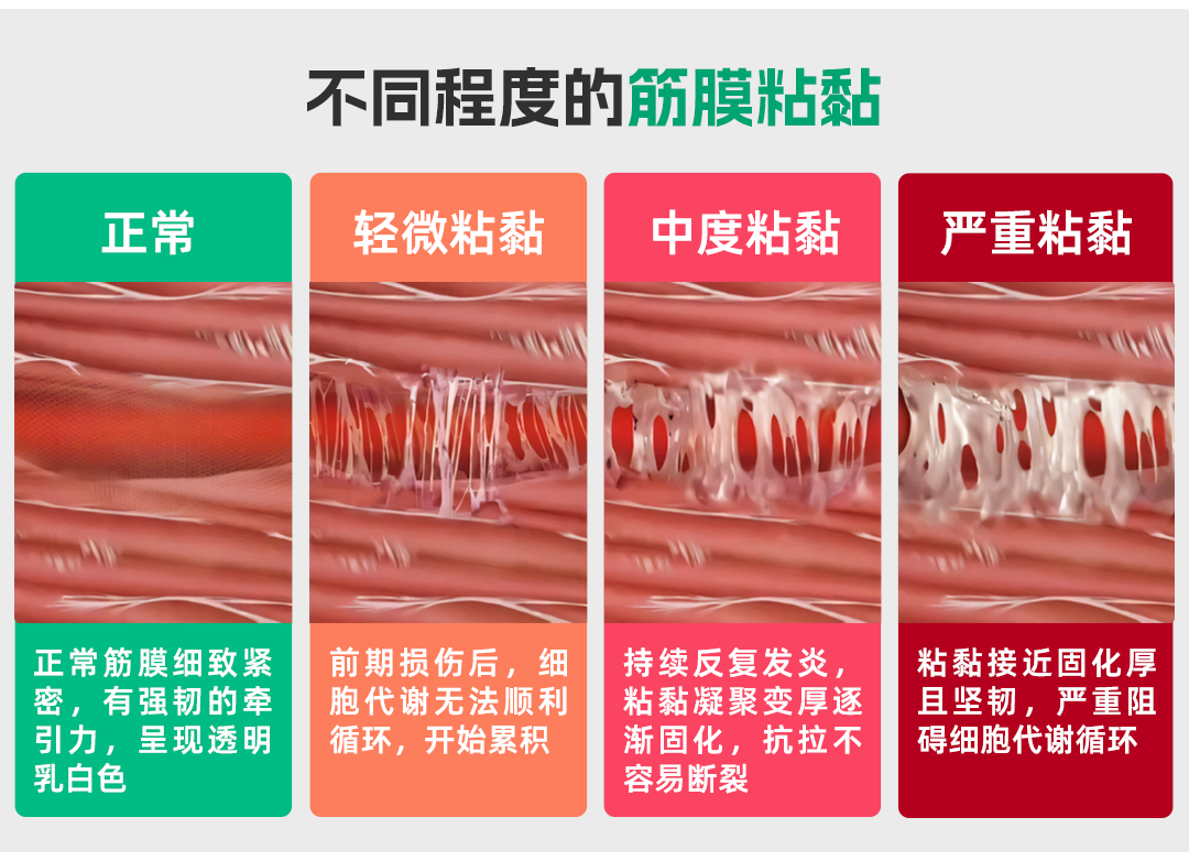 筋膜粘黏